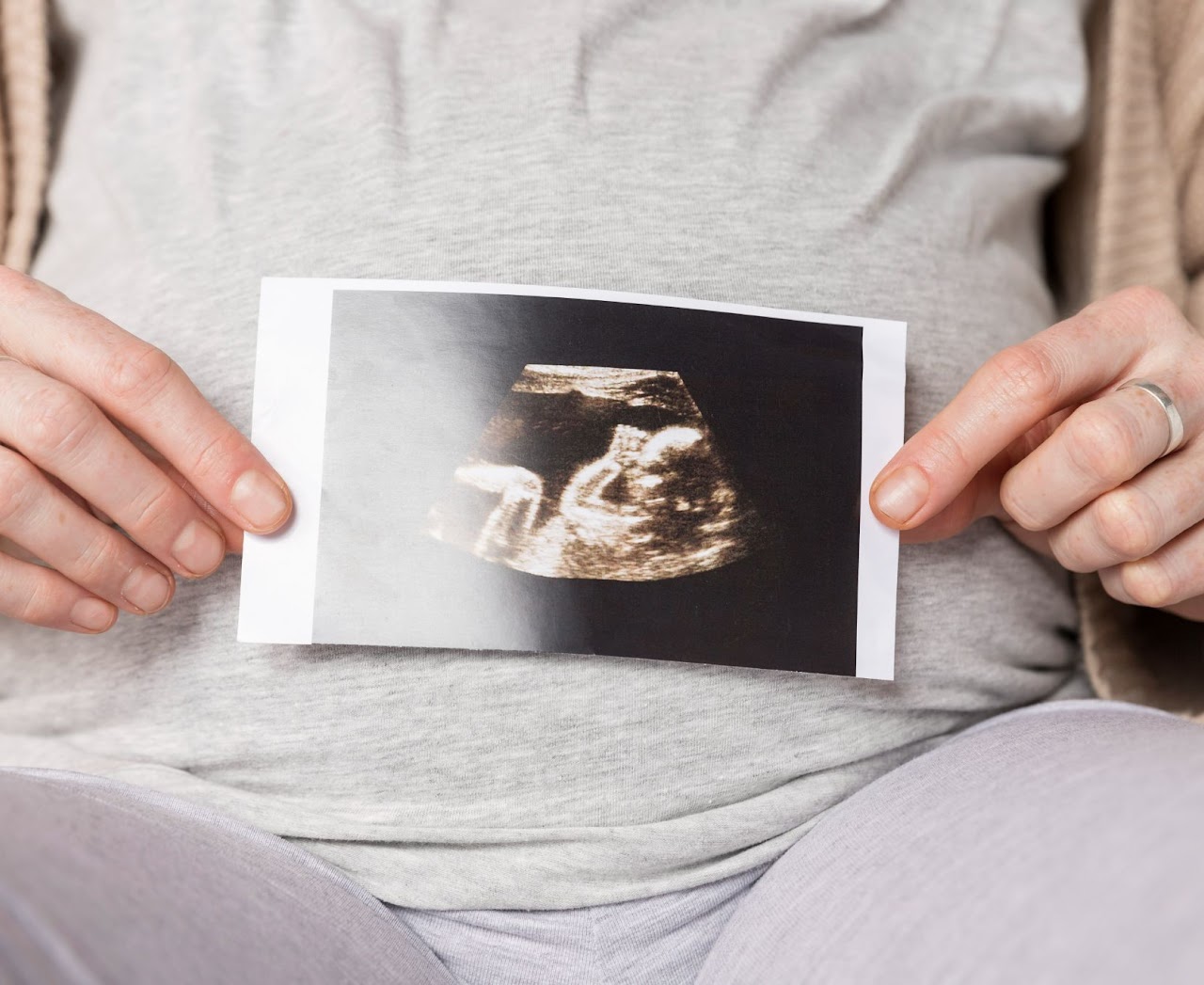 מה רואים בשקיפות עורפית